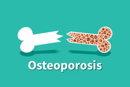 Osteoporosis - Fact File by QNET